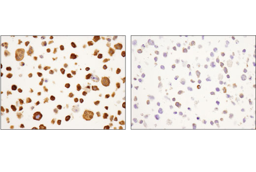 Human Reactive Cell Death and Autophagy Antibody Sampler Kit