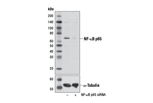 NF-kappaB p65 (L8F6) Mouse mAb