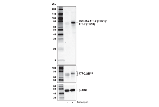 Phospho-p38 MAPK Pathway Antibody Sampler Kit