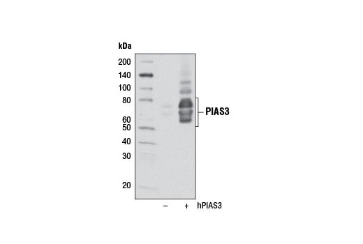 Jak/Stat Pathway Inhibitors Antibody Sampler Kit