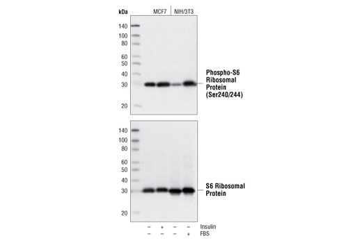 Phospho-S6 Ribosomal Protein (Ser240/244) (D68F8) XP ®  Rabbit mAb