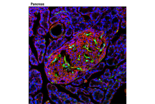 Phospho-VEGF Receptor 2 Antibody Sampler Kit