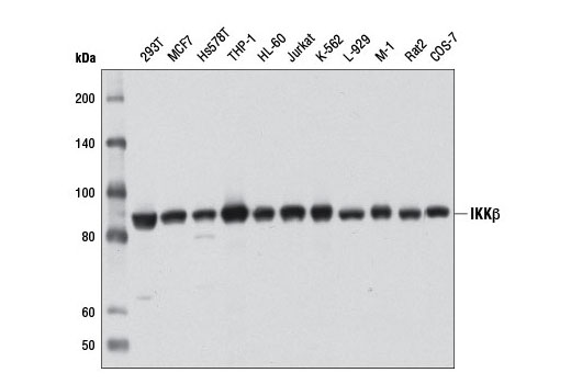 IKKβ (D30C6) Rabbit mAb