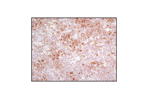 ER Stress-induced Autophagy Antibody Sampler Kit