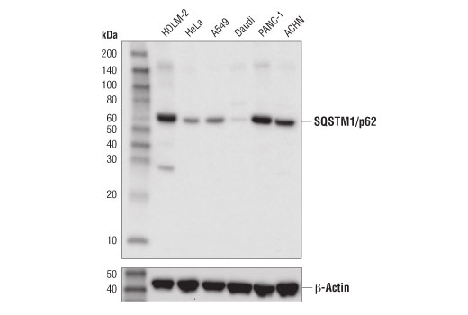SQSTM1/p62 (D5L7G) Mouse mAb