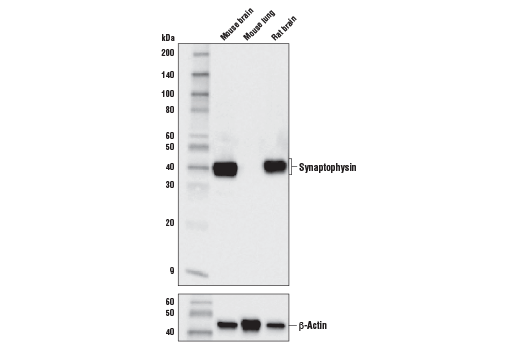 Synaptophysin (D8F6H) XP ®  Rabbit mAb