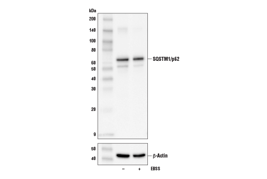 SQSTM1/p62 (D6M5X) Rabbit mAb