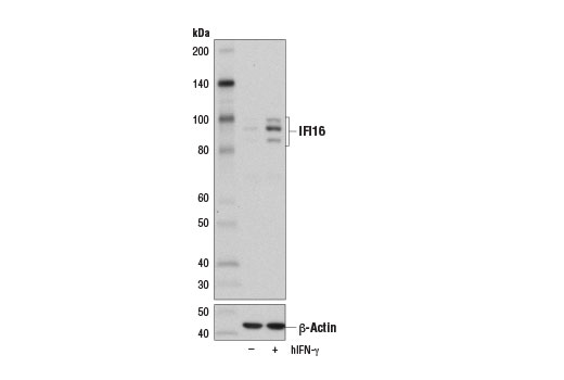 IFI16 (D8B5T) Rabbit mAb