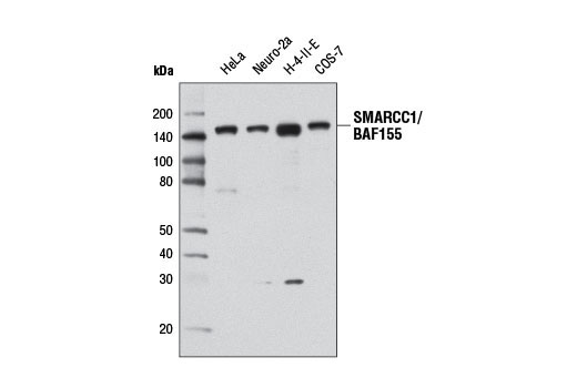 SMARCC1/BAF155 (D7F8S) Rabbit mAb