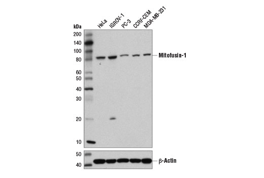 Mitochondrial Dynamics Antibody Sampler Kit II
