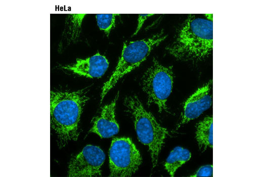 ProLong®Gold Antifade Reagent with DAPI