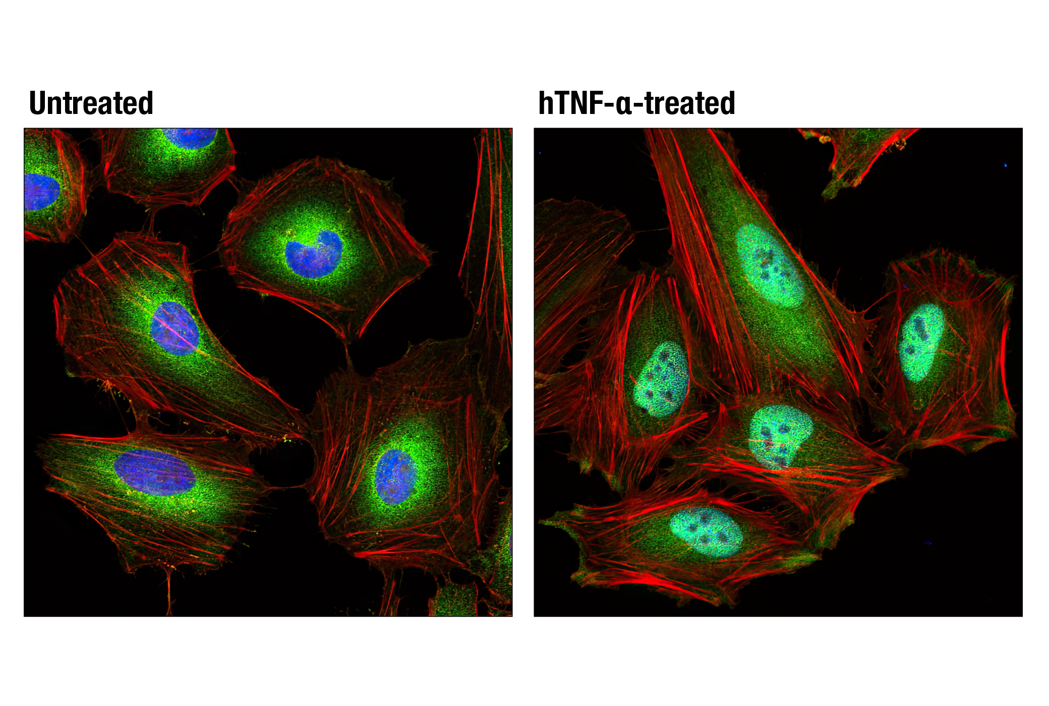 NF-kappaB Family Member Antibody Sampler Kit