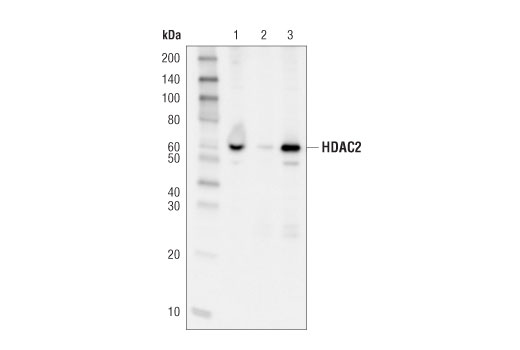 Class I HDAC Antibody Sampler Kit