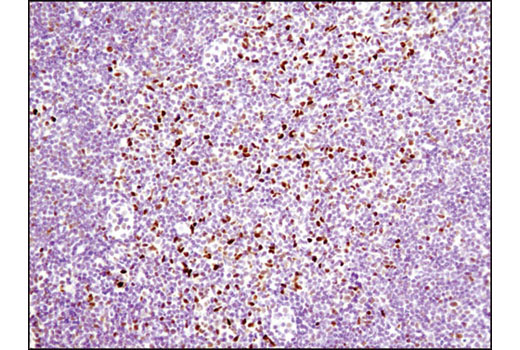 Notch Receptor Interaction Antibody Sampler Kit
