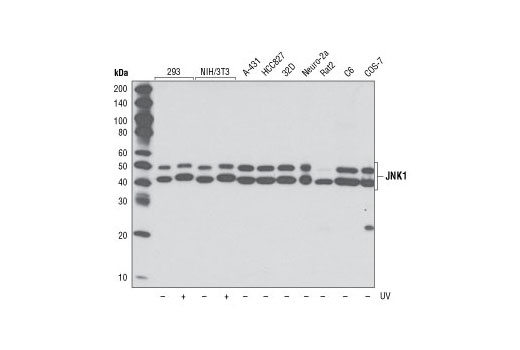 ER Stress-induced Autophagy Antibody Sampler Kit