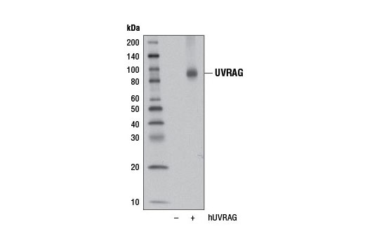 Beclin-1 Complex Antibody Sampler Kit