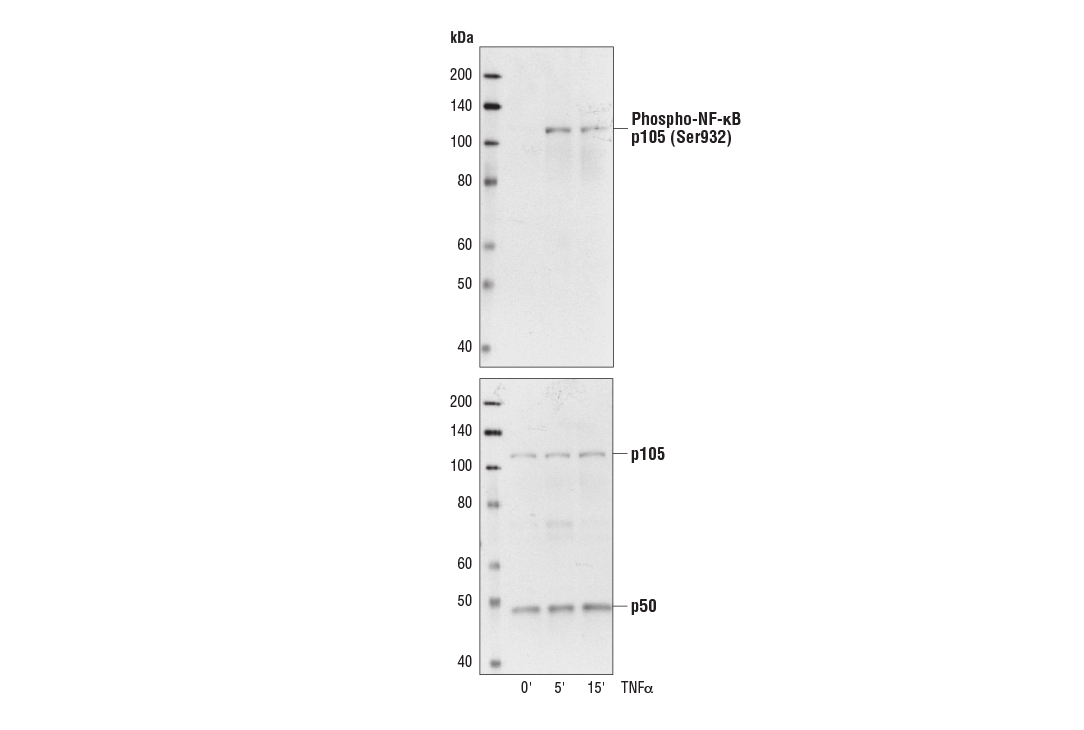 Phospho-NF-kappaB p105 (Ser932) (18E6) Rabbit mAb