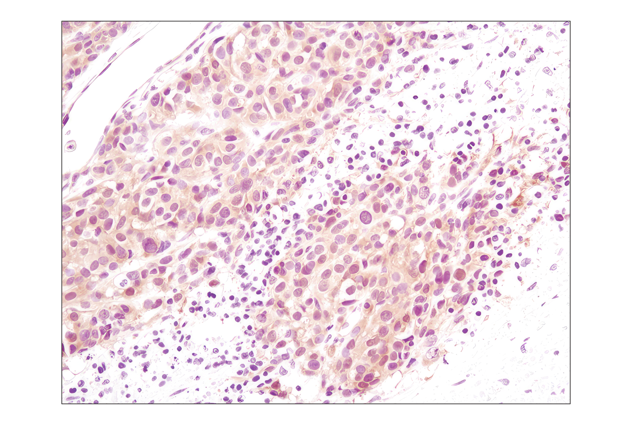 Phospho-Akt Isoform Antibody Sampler Kit