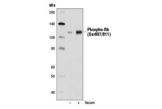 Phospho-Rb (Ser807/811) (D20B12) XP ®  Rabbit mAb