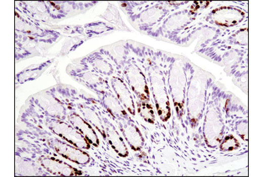 Ki-67 (D3B5) Rabbit mAb (IHC Formulated)