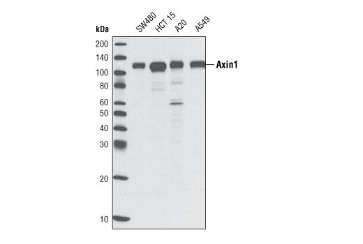 Wnt Signaling Antibody Sampler Kit