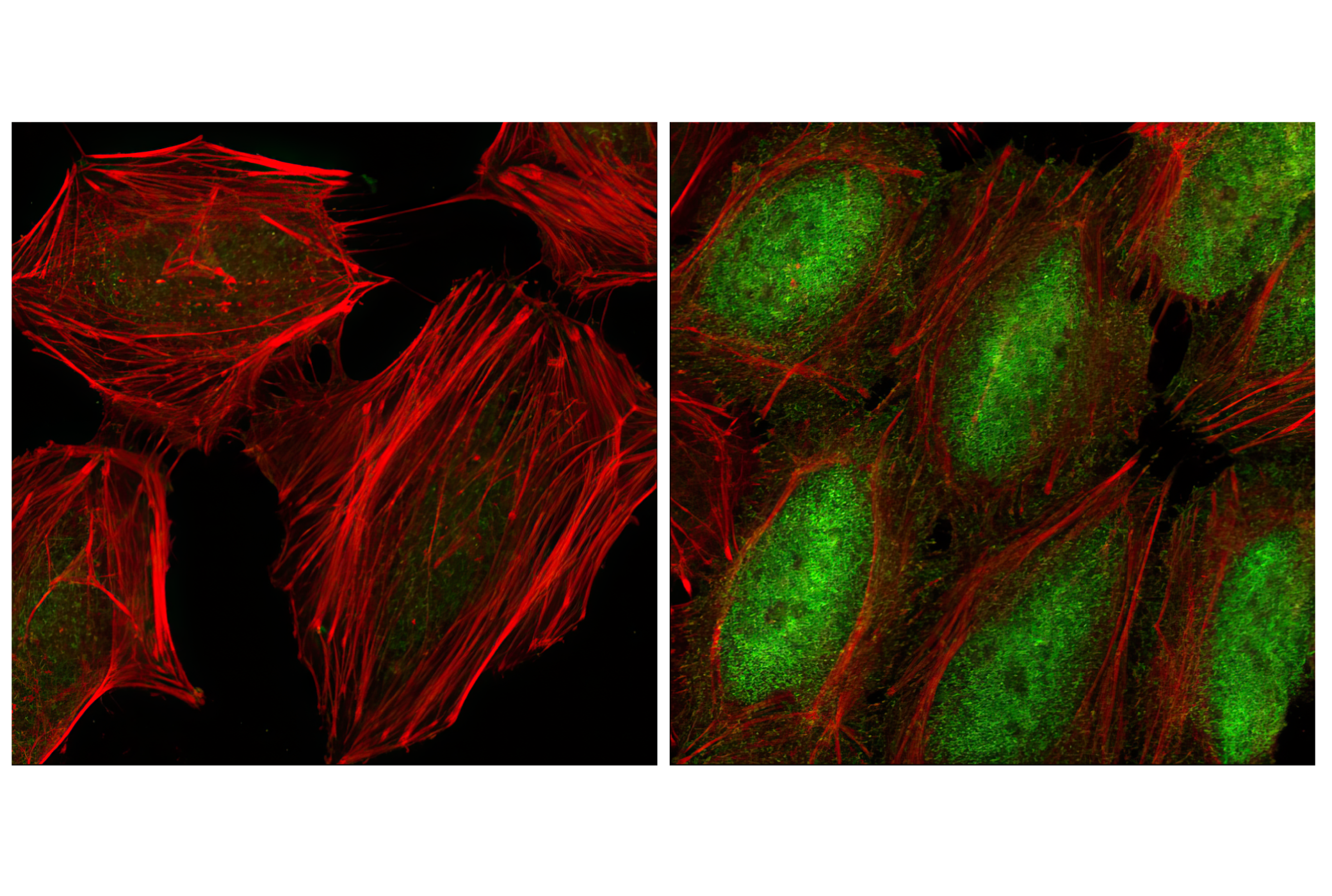 NF-kappaB Pathway Antibody Sampler Kit