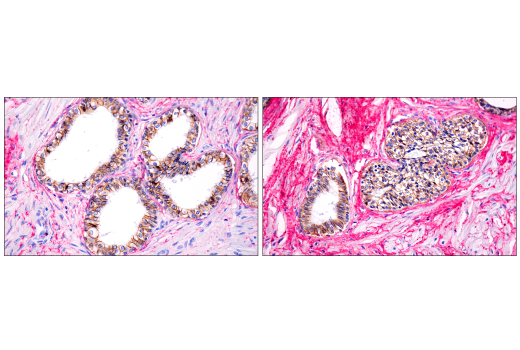 SignalStain ®  IHC Dual Staining Kit (AP, Rabbit, Red / HRP, Mouse, Brown)