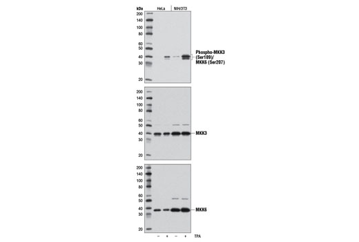 Phospho-p38 MAPK Pathway Antibody Sampler Kit