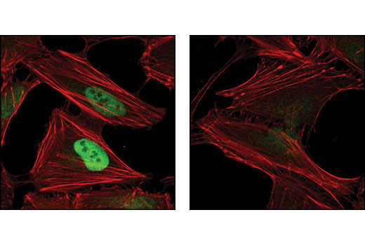 Hypoxia Pathway Antibody Sampler Kit