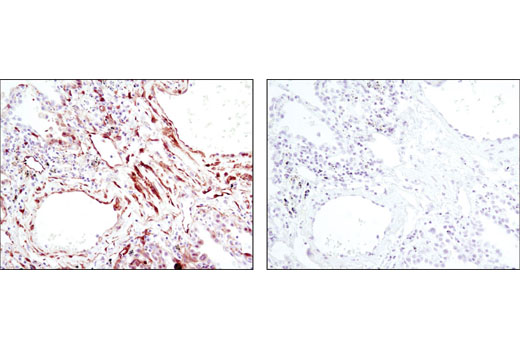 Phospho-p38 MAPK Pathway Antibody Sampler Kit