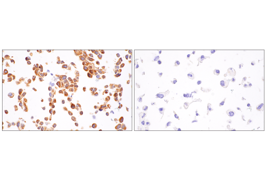 NF-kappaB Family Member Antibody Sampler Kit