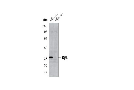 mTOR Pathway Antibody Sampler Kit