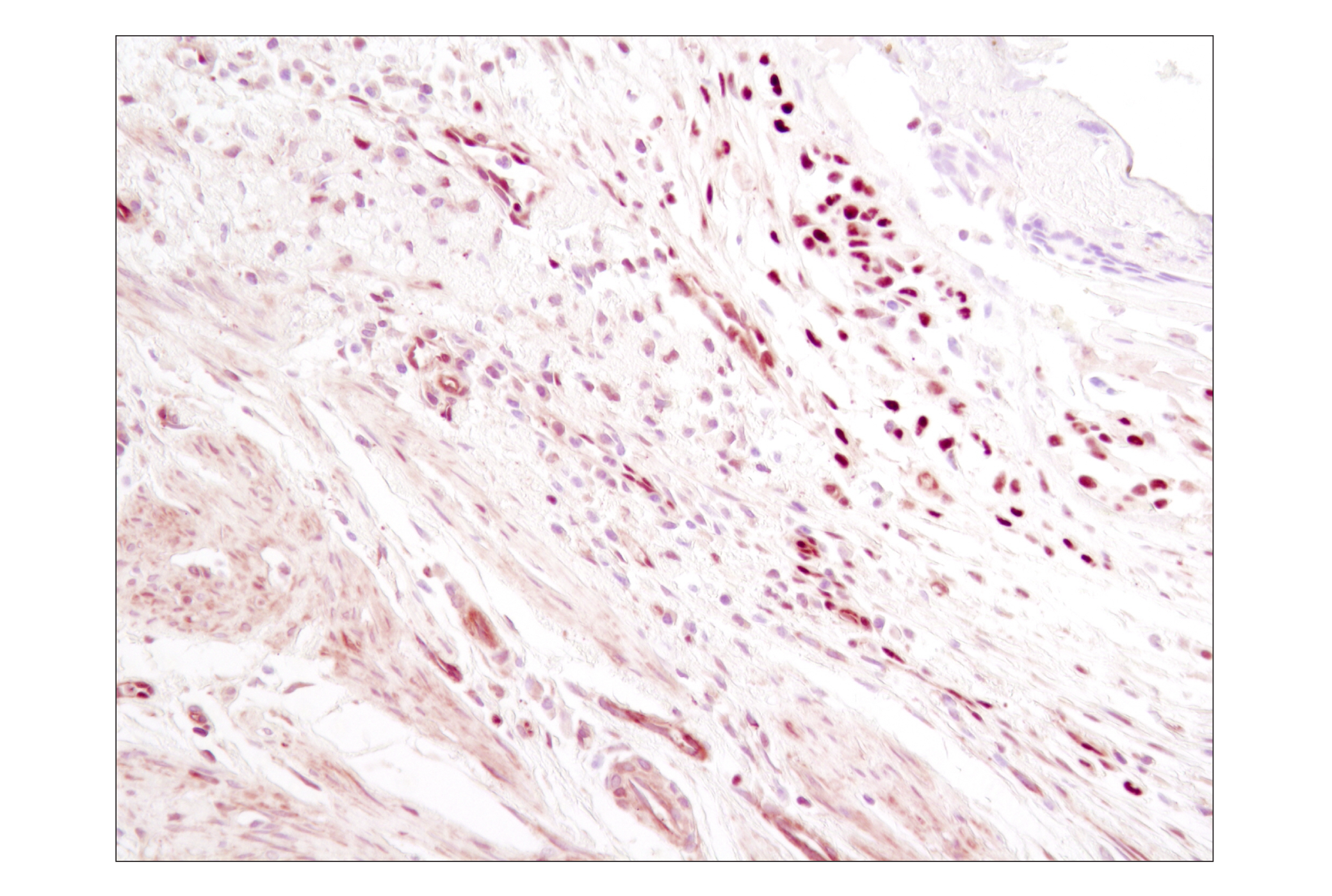 NF-kappaB Family Member Antibody Sampler Kit