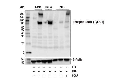 Phospho-Stat1 (Tyr701) (58D6) Rabbit mAb