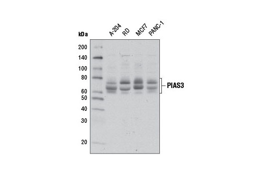 Jak/Stat Pathway Inhibitors Antibody Sampler Kit