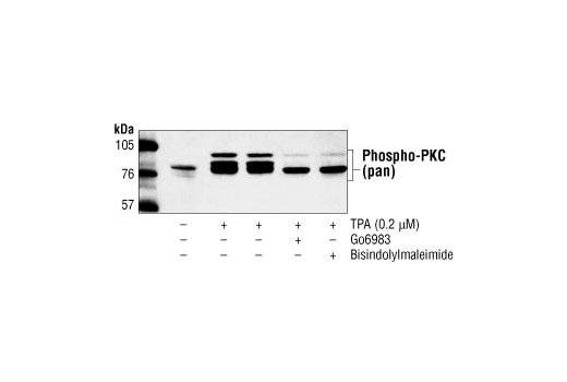 Phospho-PKC (pan) (betaII Ser660) Antibody