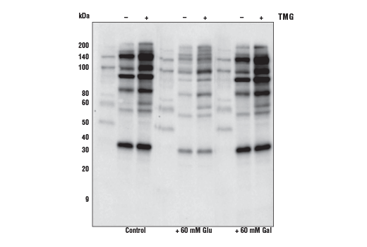 O-GlcNAc MultiMab™ Rabbit mAb mix