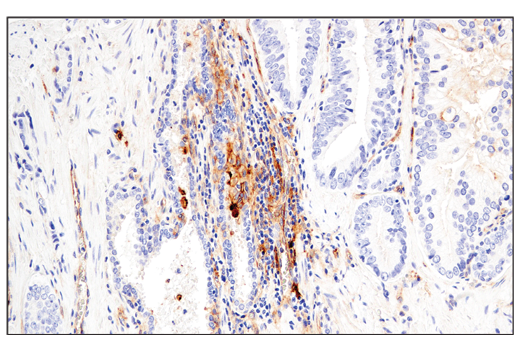 Exosomal Marker Antibody Sampler Kit