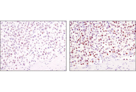 SignalStain ®  Boost IHC Detection Reagent (HRP, Mouse)