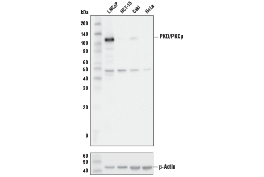 PKD/PKCmu (D4J1N) Rabbit mAb
