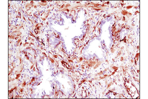 Phospho-p38 MAPK Pathway Antibody Sampler Kit
