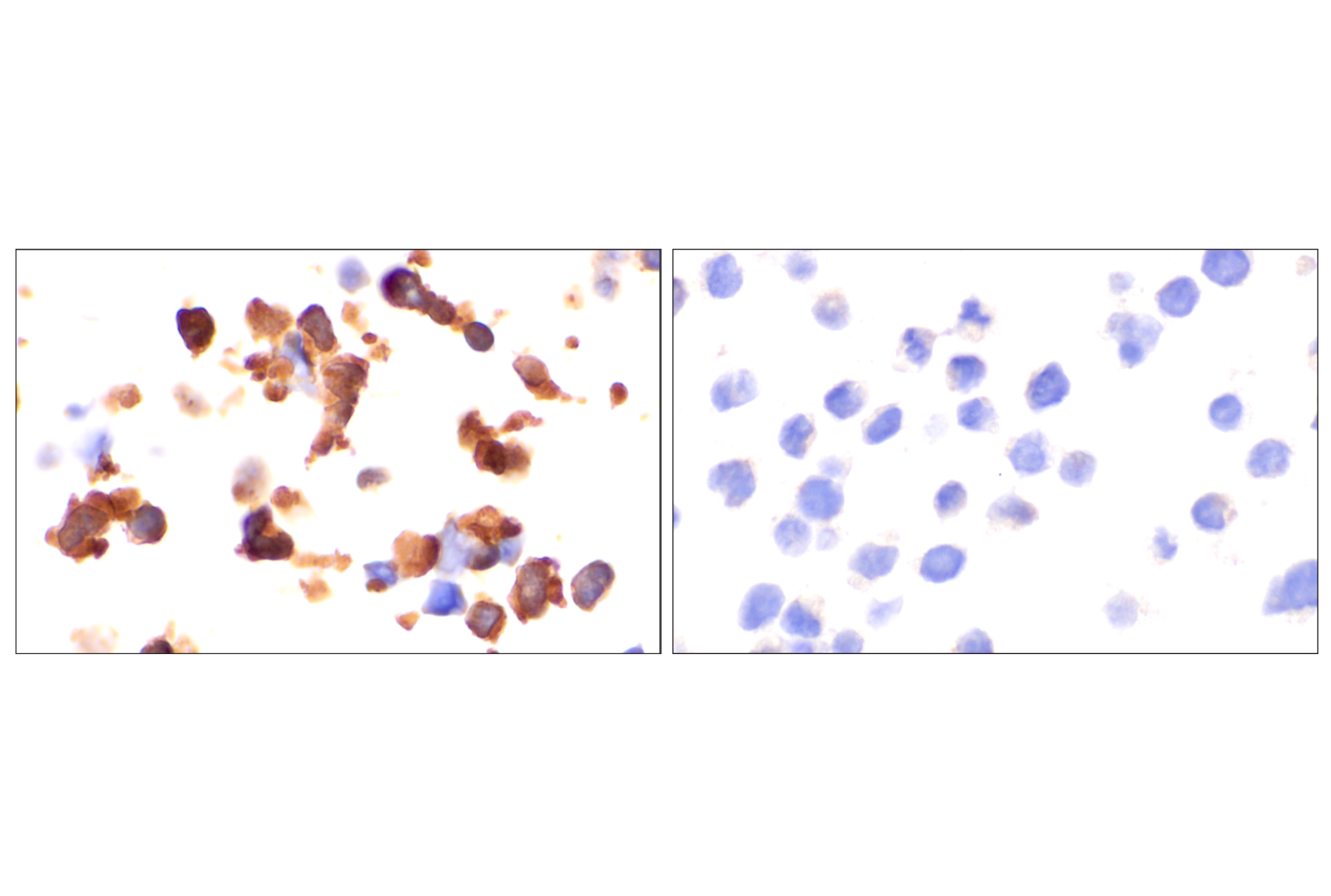 Hippo Pathway: Upstream Signaling Antibody Sampler Kit