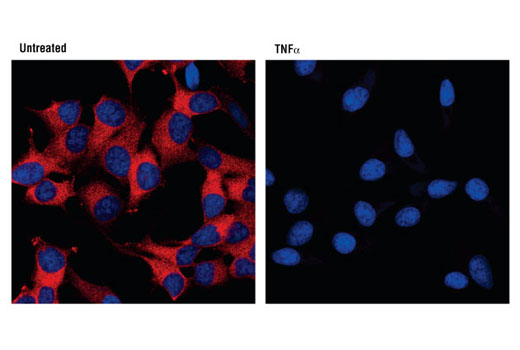 NF-kappaB Pathway Antibody Sampler Kit