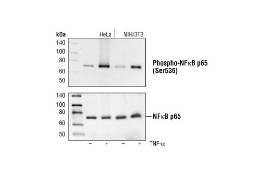 Phospho-NF-kappaB p65 (Ser536) (93H1) Rabbit mAb