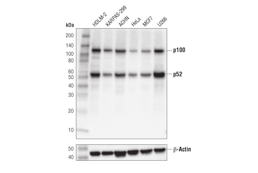 NF-kappaB Family Antibody Sampler Kit II