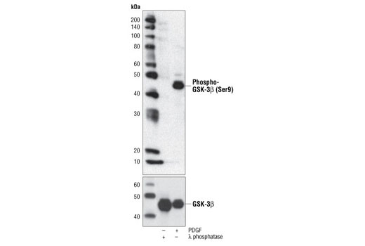 Phospho-GSK-3beta (Ser9) (5B3) Rabbit mAb