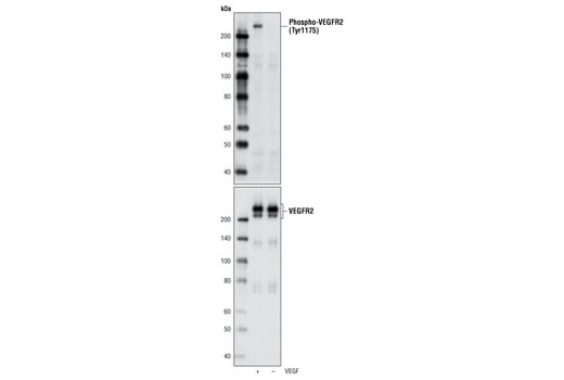 Phospho-VEGF Receptor 2 Antibody Sampler Kit