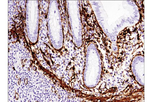 Cancer Associated Fibroblast Marker Antibody Sampler Kit