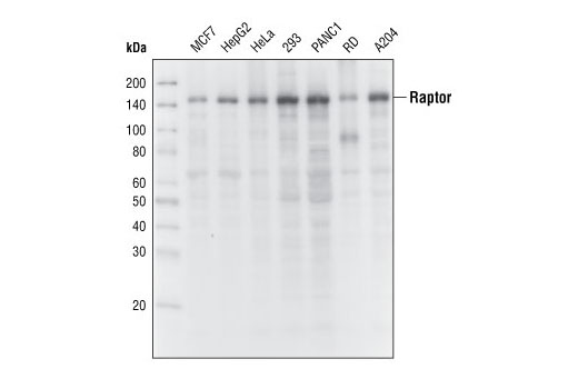 mTOR Pathway Antibody Sampler Kit