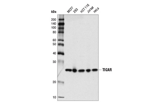 TIGAR (D3F4A) Rabbit mAb